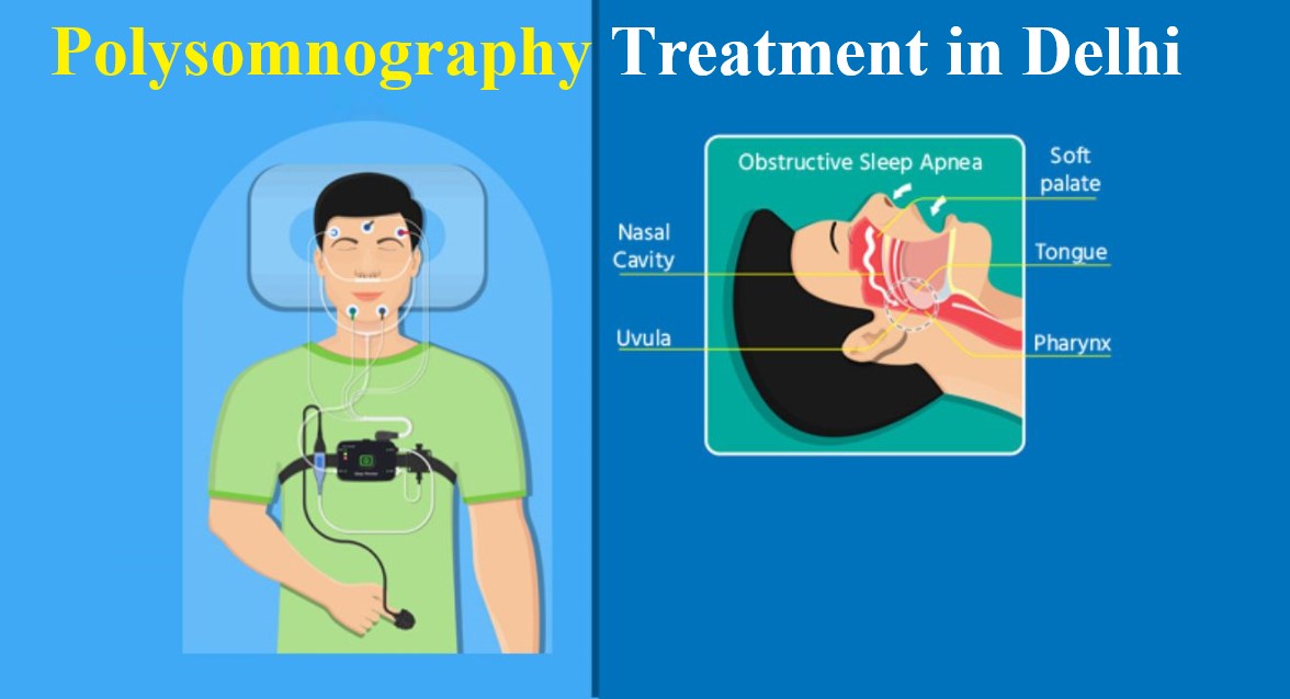 polysomnography test in delhi ncr